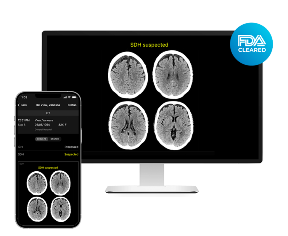 FDA批准一款AI医疗影像，一分钟识别脑出血